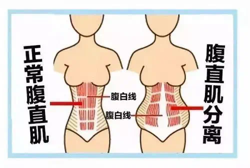 孕前小蠻腰，孕后似錢包？來(lái)看看解決辦法吧！