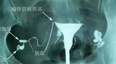 給高齡備孕女性的忠告：5個誤區(qū)，提前知道！